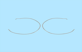 手機殼五金配件沖壓加工中要注意什么細節(jié)問題？